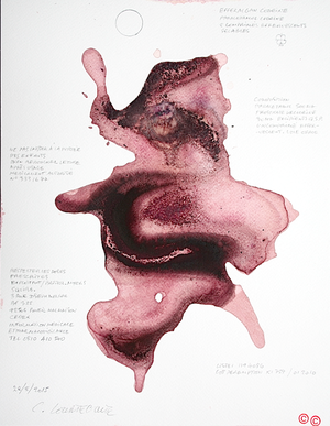 Claude Courtecuisse -  Effaralgan Codeine